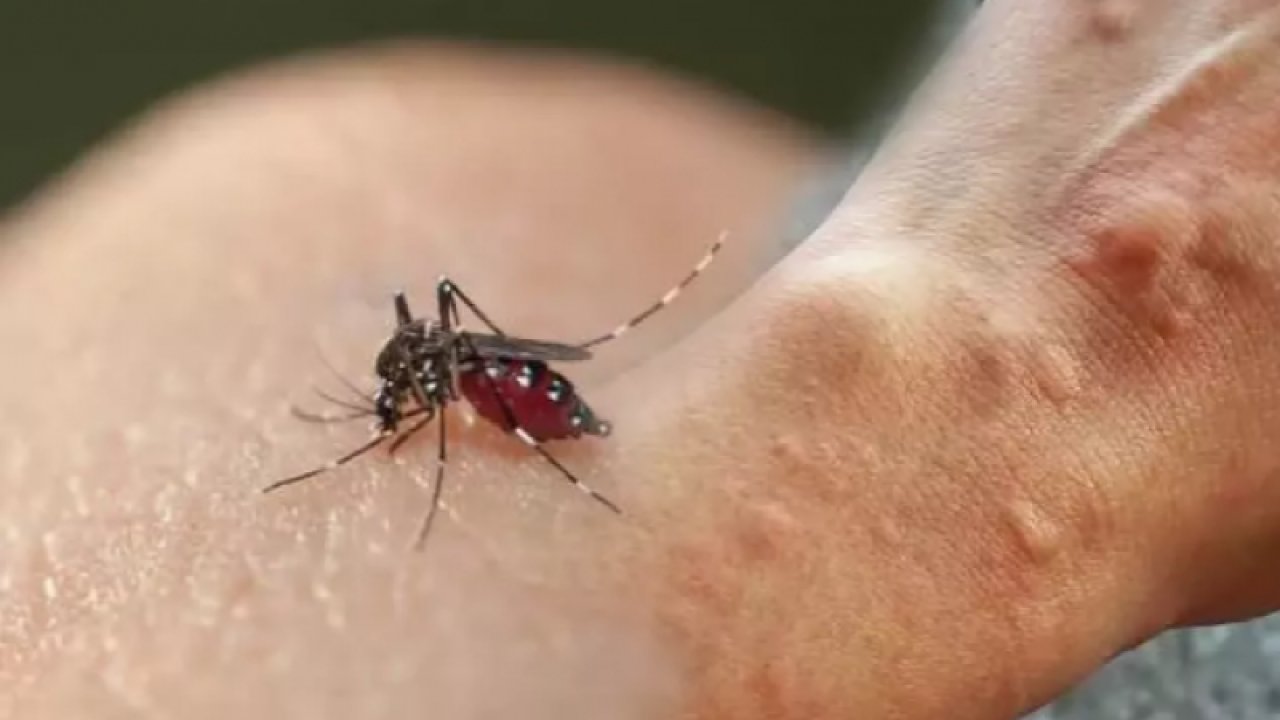 Sivrisinek ısırıklarının ardından bu belirtiler varsa dikkat! Sivrisinek ısırığından bulaşan hastalıklar neler?
