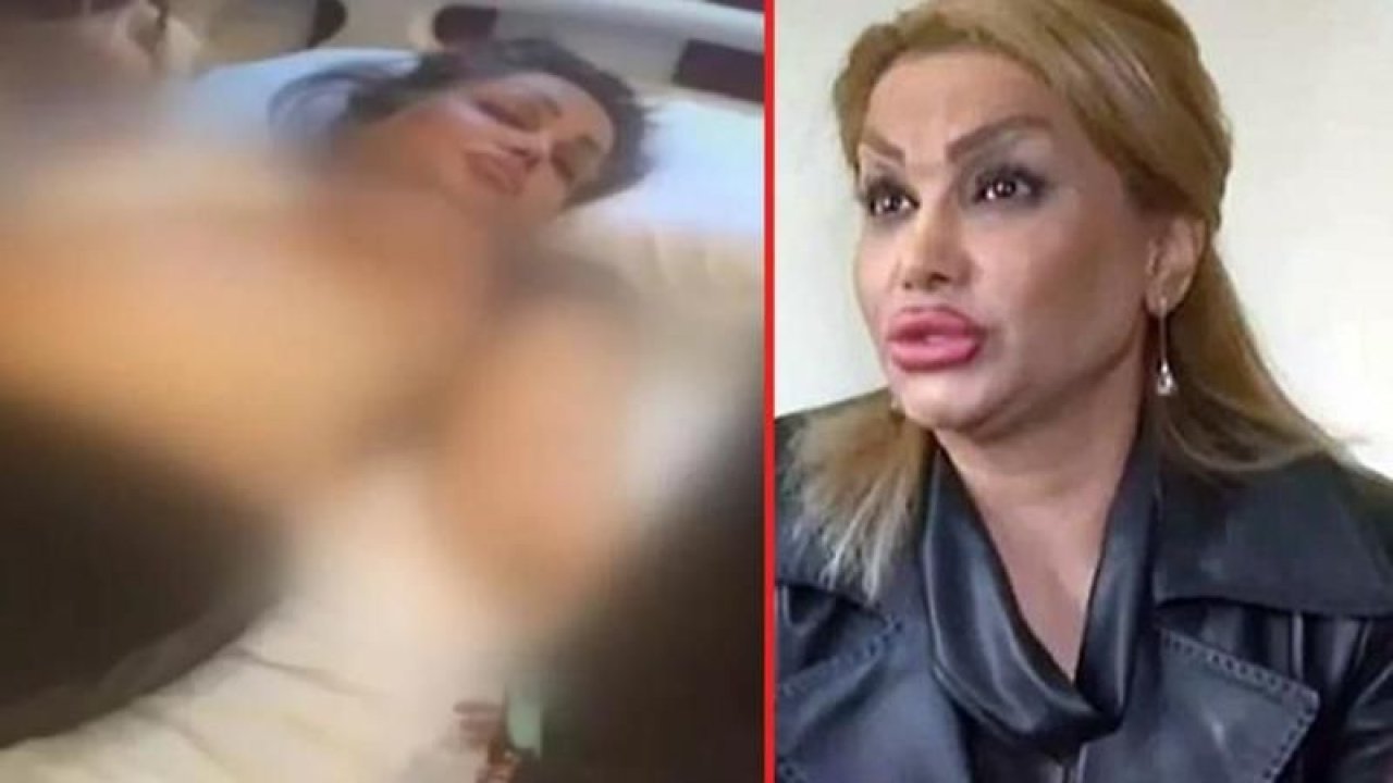 İstanbul'da göğüs küçültme ameliyatı yaptıran kadın şoke oldu! Hem göğsünden hem de kocasından oldu!
