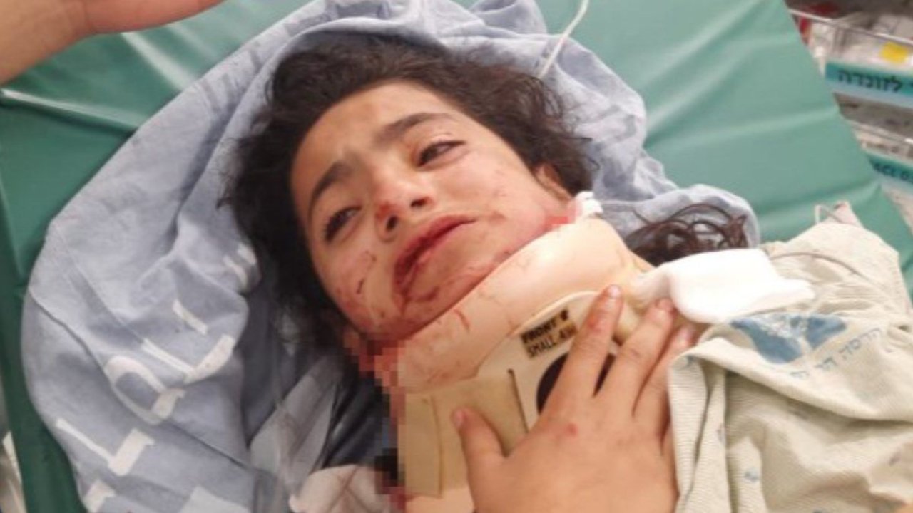 Kudüs'te de kan ağlıyor! Atılan ses bombası 11 yaşındaki küçük çocuğa isabet etti! Kanlar içinde yere yığıldı