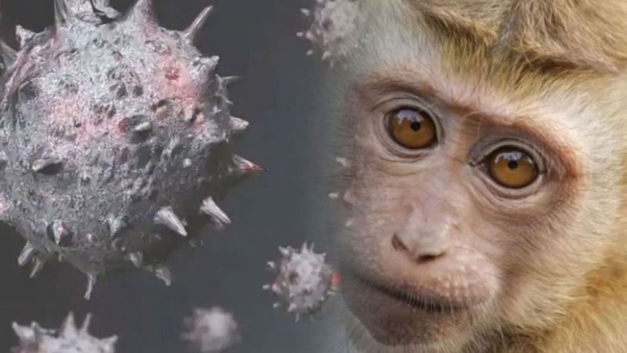 Prof. Dr. Levent Akın'dan korkutan maymun çiçeği virüsü açıklaması