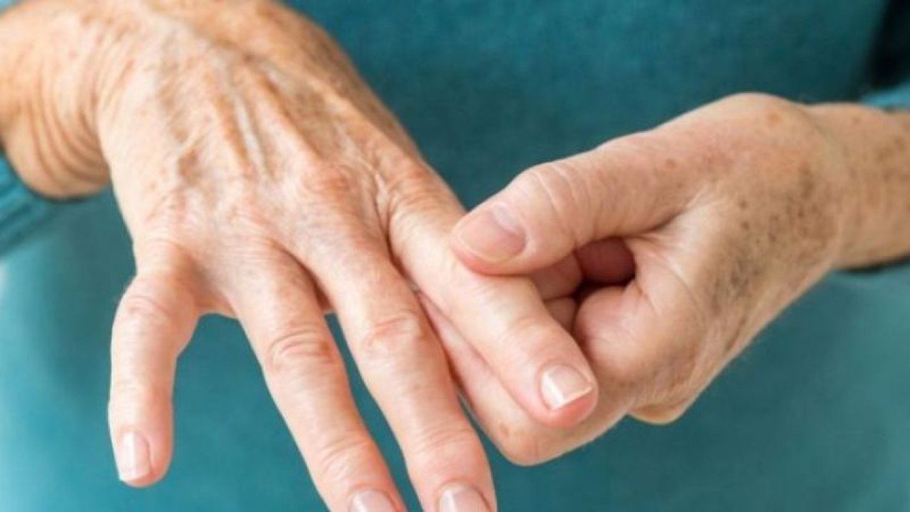 Romatoid Artrit Hastalığı, Tedavi Edilmezse Kalıcı Eklem Hasarlarına Neden Olabilir
