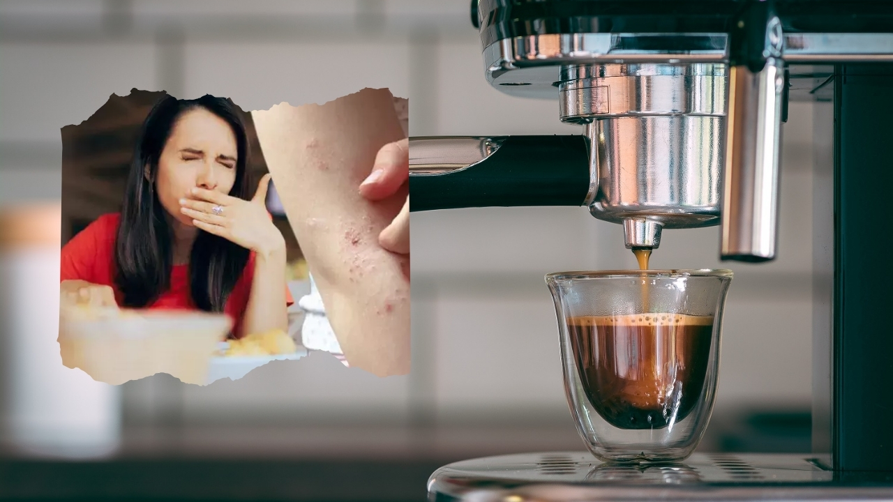 Kahve Otomatlarında Anafilaktik Şok Riski mi Var?
