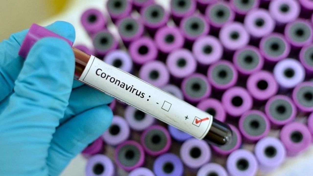 Prof. Dr. Tevfik Özlü'den korkutan uyarı: Koronavirüs vaka sayıları artmaya devam edecek