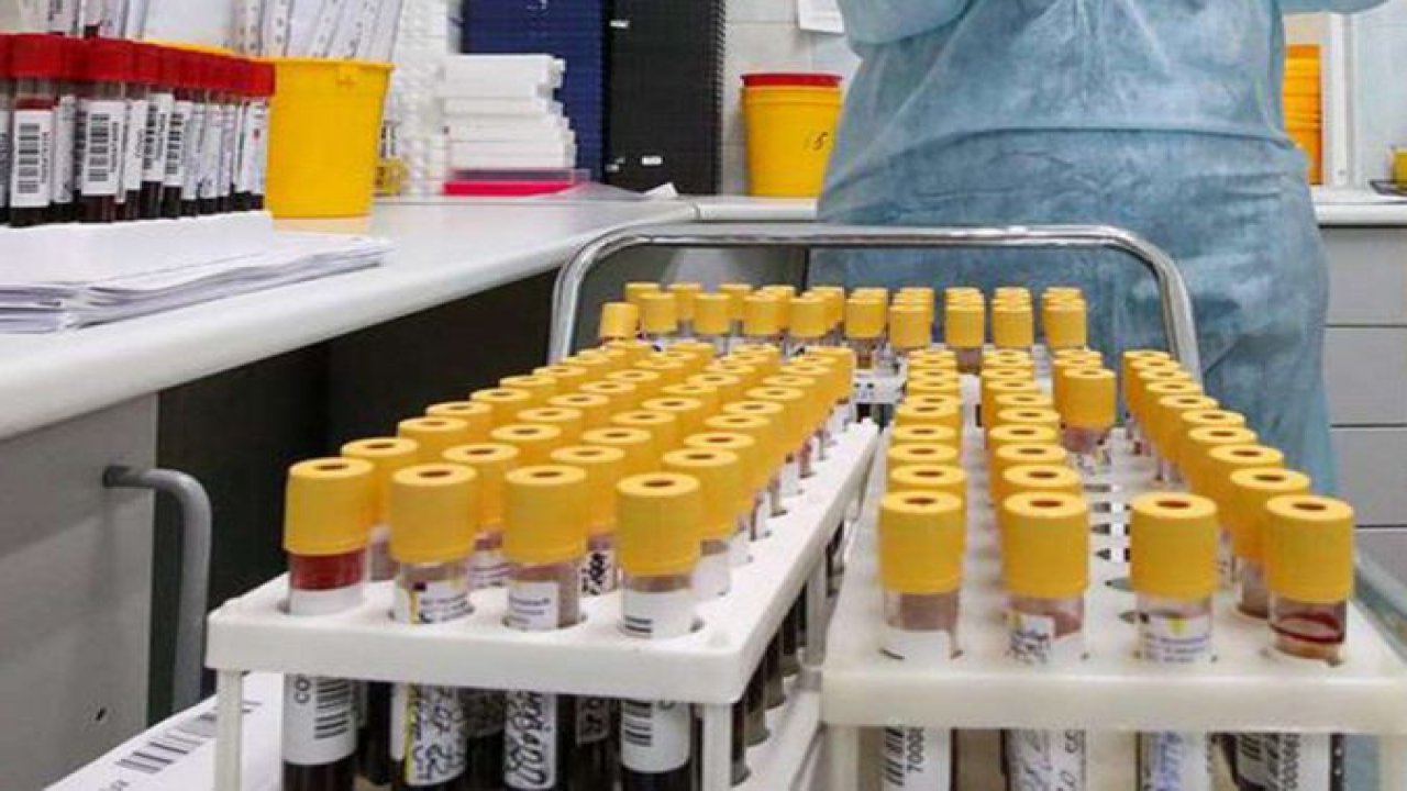 Coronavirus nedeniyle bir haftada 157 kişi hayatını kaybetti