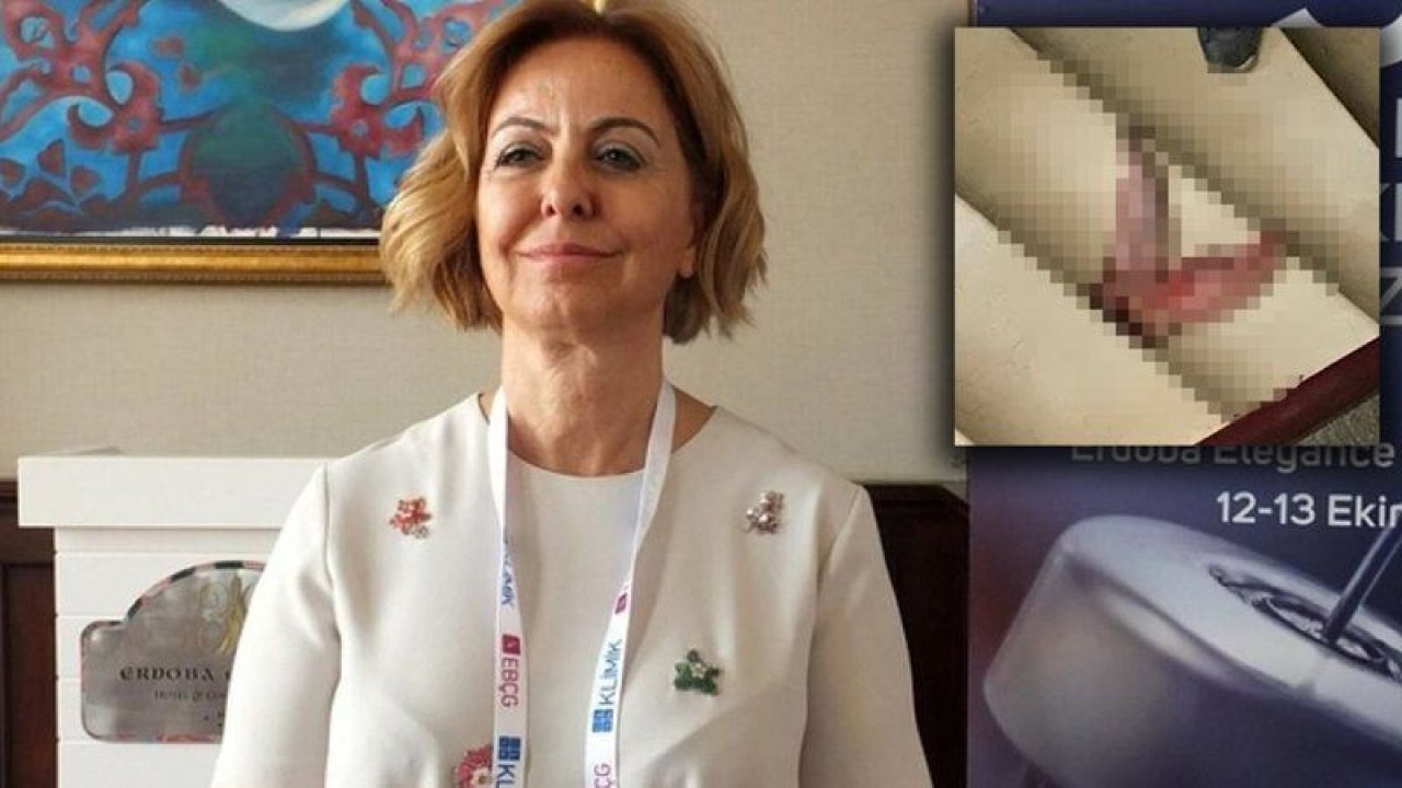 Aşı karşıtlarından cinayet girişimi! Prof. Esin Davutoğlu Şenol bir numaralı hedef